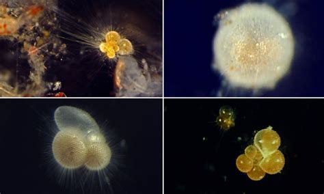 Foraminifera: These Ancient Ocean Dwellers Exhibit Stunning Diversity and Play a Crucial Role in Marine Ecosystems!