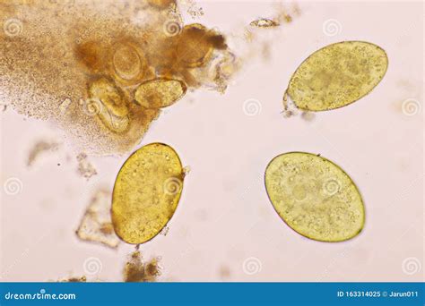 Intestinal Fluke: A Tiny Parasite That Packs a Punch – Exploring Its Remarkable Lifecycle as an Endoparasite and its Intricate Relationship with Its Host